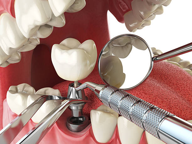 Best Broken Tooth Emergency  in Buena Vista, GA